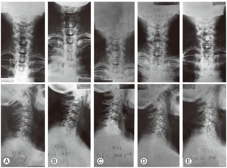 https://cdn.ncbi.nlm.nih.gov/pmc/blobs/c28d/4149986/4118572427d4/asj-8-435-g003.jpg