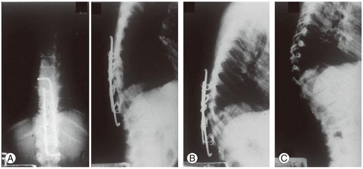 https://cdn.ncbi.nlm.nih.gov/pmc/blobs/c28d/4149986/5264148e533a/asj-8-435-g002.jpg