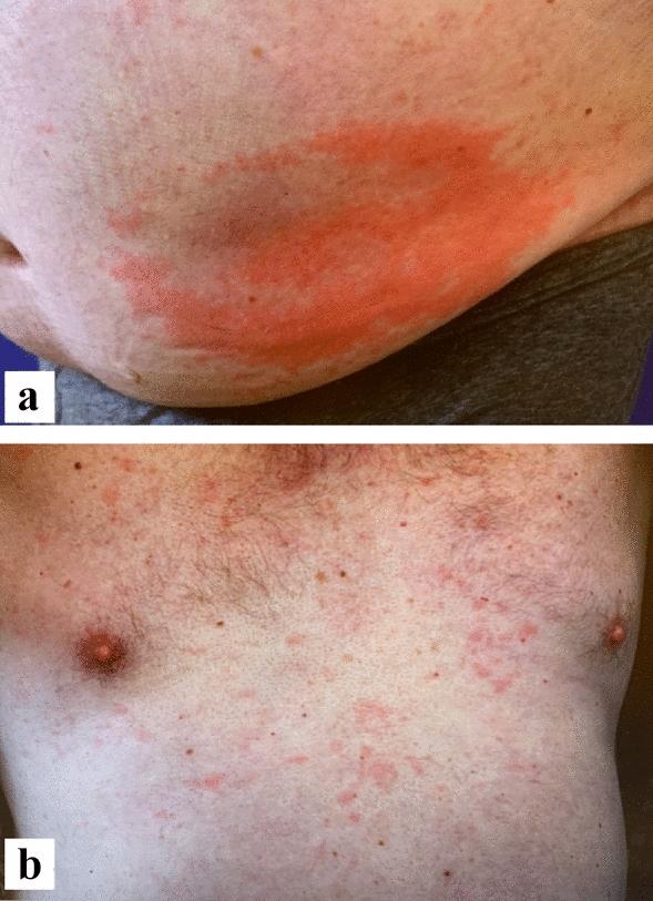 https://cdn.ncbi.nlm.nih.gov/pmc/blobs/c290/10373319/4f456cc3016e/13223_2023_819_Fig3_HTML.jpg