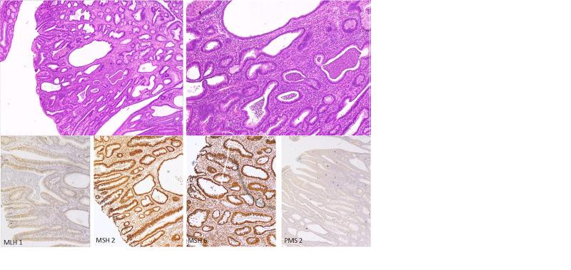 https://cdn.ncbi.nlm.nih.gov/pmc/blobs/c290/7805505/a44a49b6d316/cureus-0012-00000012092-i02.jpg