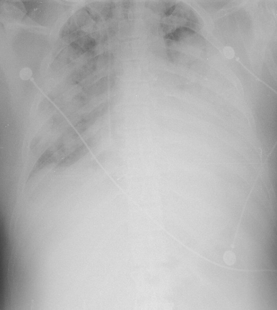 https://cdn.ncbi.nlm.nih.gov/pmc/blobs/c293/8067291/eae034cbb07b/12890_2021_1501_Fig1_HTML.jpg