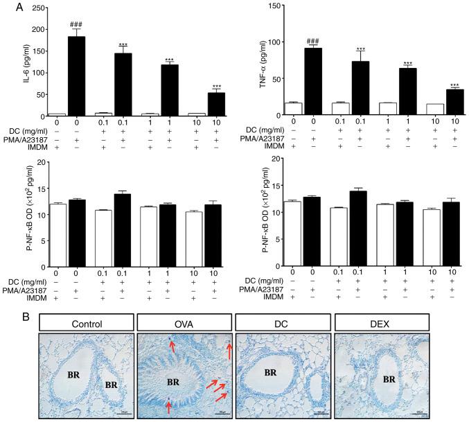 https://cdn.ncbi.nlm.nih.gov/pmc/blobs/c294/7533436/2eabcdb52166/MMR-22-05-3597-g05.jpg