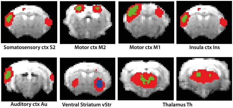 https://cdn.ncbi.nlm.nih.gov/pmc/blobs/c297/5289996/72ccdcb719a5/fncir-11-00005-g0002.jpg
