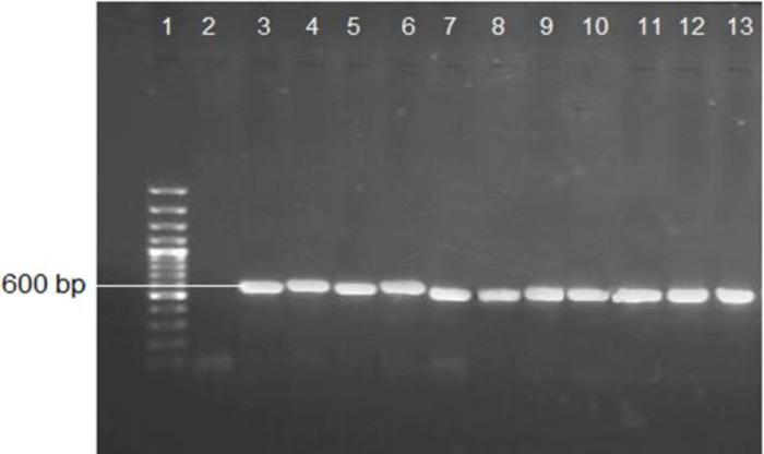 https://cdn.ncbi.nlm.nih.gov/pmc/blobs/c2ab/5763893/6ba5bfdabb14/cmm-3-013-g001.jpg