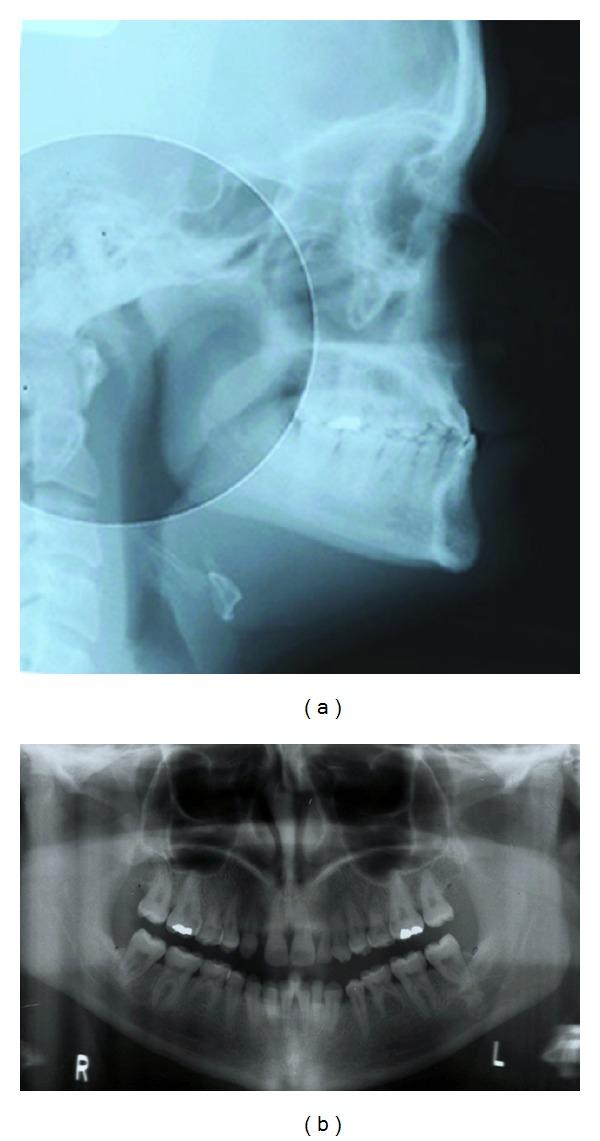 https://cdn.ncbi.nlm.nih.gov/pmc/blobs/c2b2/3426224/3bb3bbd0fccf/IJD2012-872367.001.jpg