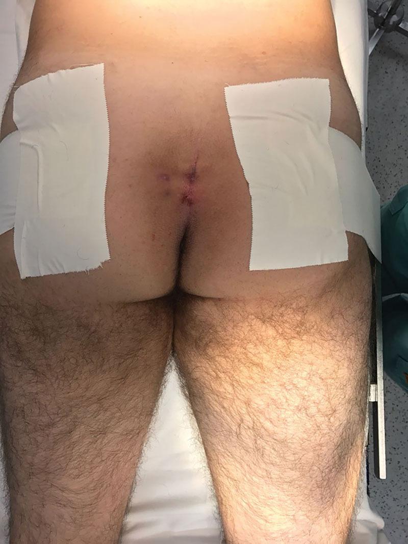 https://cdn.ncbi.nlm.nih.gov/pmc/blobs/c2b5/8062152/f9e803b21cc5/gox-9-e3473-g002.jpg
