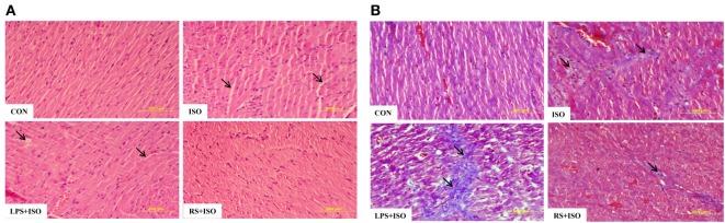 https://cdn.ncbi.nlm.nih.gov/pmc/blobs/c2b7/5479928/5a61afaed10b/fimmu-08-00719-g002.jpg