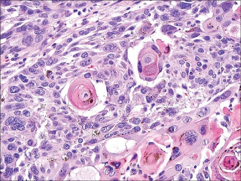 https://cdn.ncbi.nlm.nih.gov/pmc/blobs/c2ba/4439757/18591a8109d1/IDOJ-6-217-g004.jpg