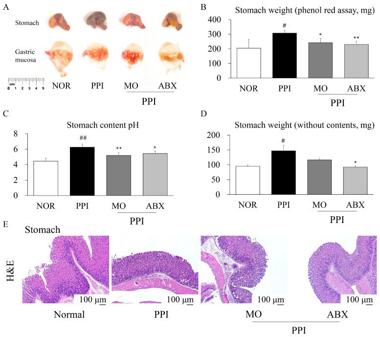 https://cdn.ncbi.nlm.nih.gov/pmc/blobs/c2bc/12108370/481c70f20e0c/antibiotics-14-00442-g002.jpg
