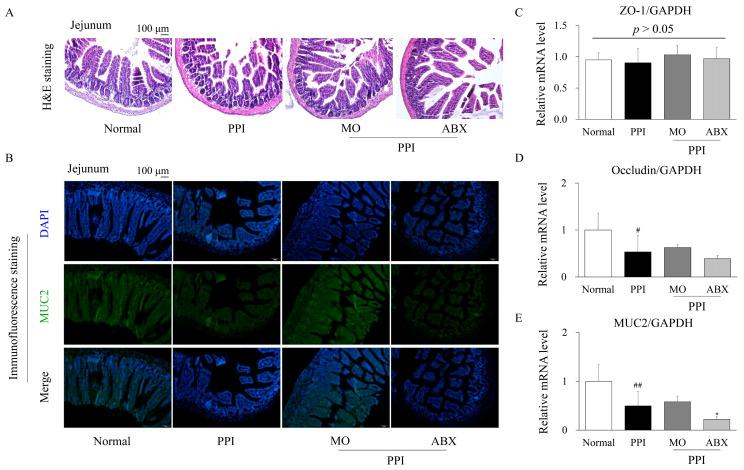 https://cdn.ncbi.nlm.nih.gov/pmc/blobs/c2bc/12108370/abab351535cc/antibiotics-14-00442-g004.jpg