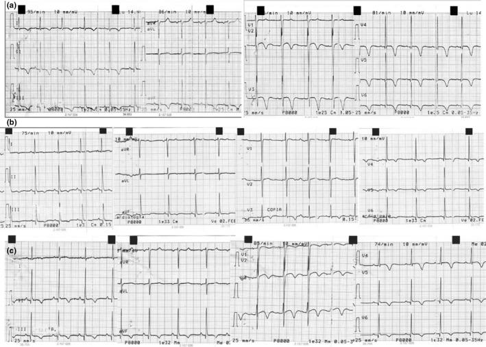 https://cdn.ncbi.nlm.nih.gov/pmc/blobs/c2c4/8293611/4ed547881822/ANEC-26-e12813-g001.jpg