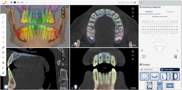 https://cdn.ncbi.nlm.nih.gov/pmc/blobs/c2c5/11715142/e240604d789e/IEJ-58-155-g037.jpg