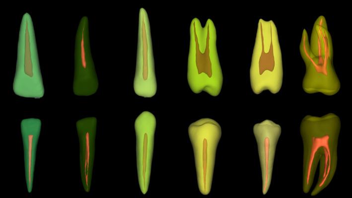 https://cdn.ncbi.nlm.nih.gov/pmc/blobs/c2c5/11715142/f5d67e136bc2/IEJ-58-155-g012.jpg