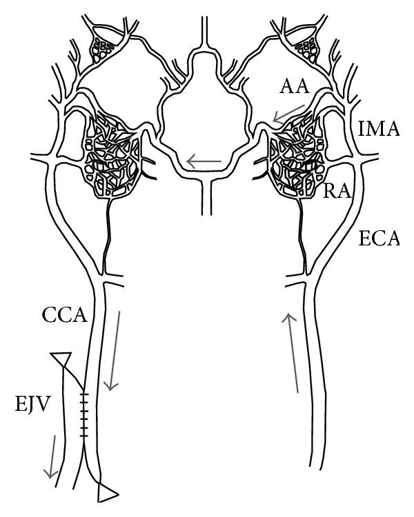 https://cdn.ncbi.nlm.nih.gov/pmc/blobs/c2c7/4663287/14bfbc5b0e22/BMRI2015-178407.003.jpg