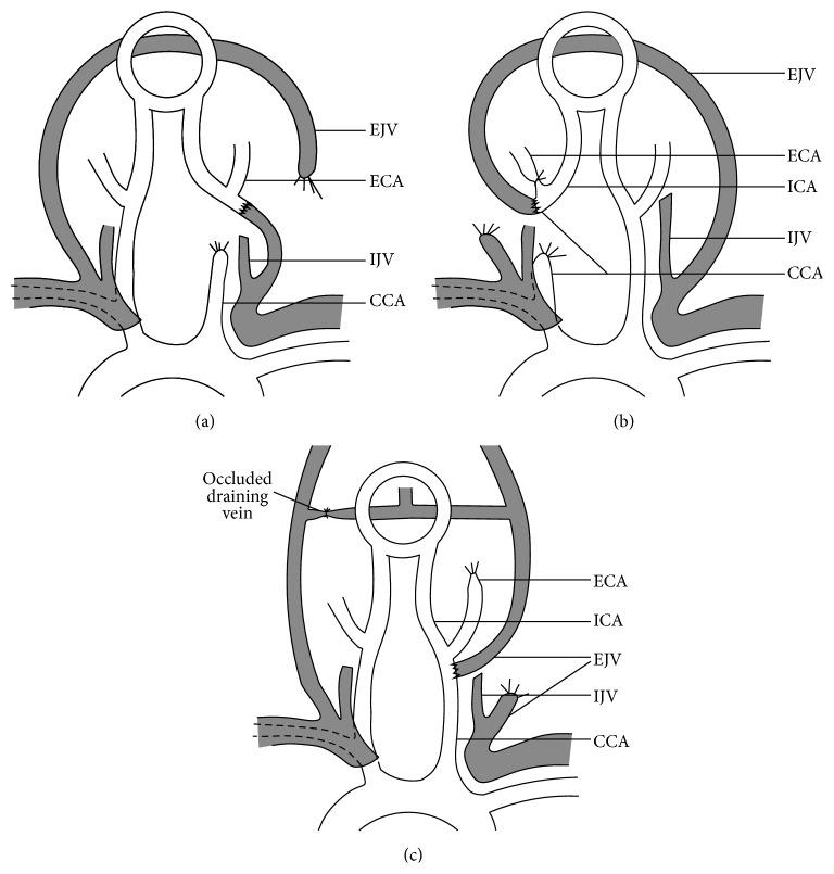 https://cdn.ncbi.nlm.nih.gov/pmc/blobs/c2c7/4663287/ac64d6c78cae/BMRI2015-178407.001.jpg
