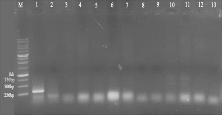 https://cdn.ncbi.nlm.nih.gov/pmc/blobs/c2c8/11697468/1fb383e8ad8b/12870_2024_6027_Fig2_HTML.jpg