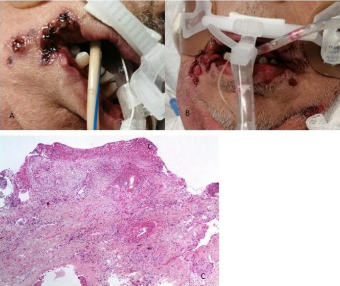 https://cdn.ncbi.nlm.nih.gov/pmc/blobs/c2d1/10462920/348f945b812e/joddd-17-54-g002.jpg