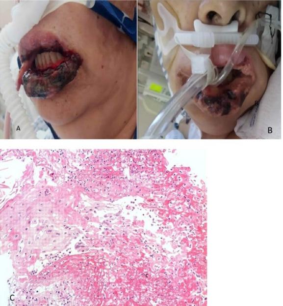 https://cdn.ncbi.nlm.nih.gov/pmc/blobs/c2d1/10462920/aa1bae81edeb/joddd-17-54-g004.jpg