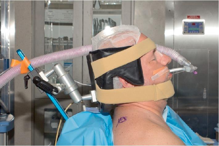 https://cdn.ncbi.nlm.nih.gov/pmc/blobs/c2d1/6855057/5d71b64ad489/CRIA2019-5392847.001.jpg