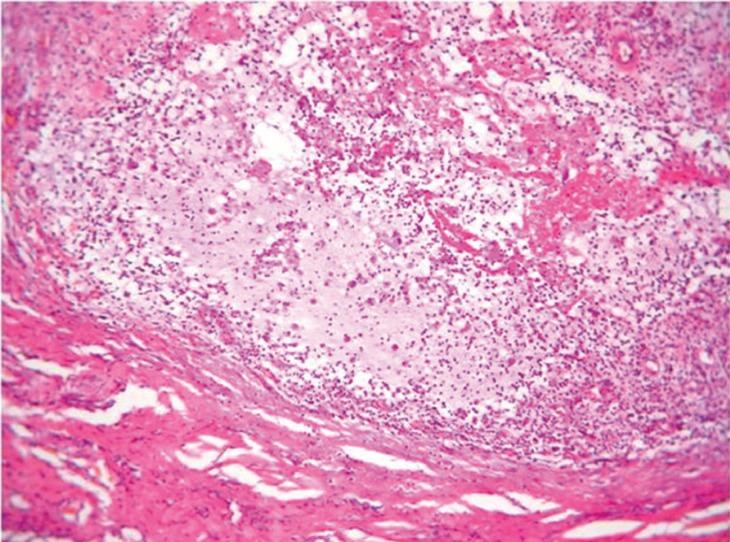 https://cdn.ncbi.nlm.nih.gov/pmc/blobs/c2da/5971079/20eb4cdc9821/jced-10-e495-g002.jpg