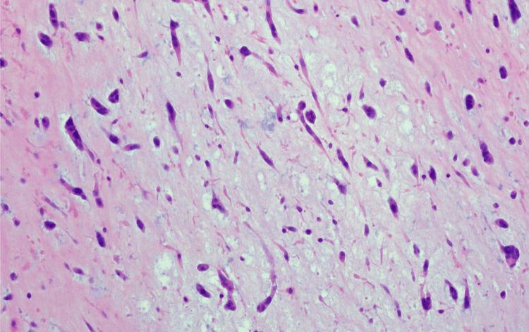 https://cdn.ncbi.nlm.nih.gov/pmc/blobs/c2e0/12001298/4e784cfd57f5/cureus-0017-00000081801-i05.jpg