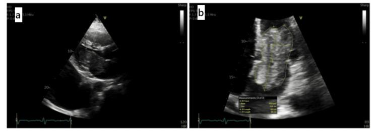 https://cdn.ncbi.nlm.nih.gov/pmc/blobs/c2e0/12001298/a810a96c9159/cureus-0017-00000081801-i02.jpg