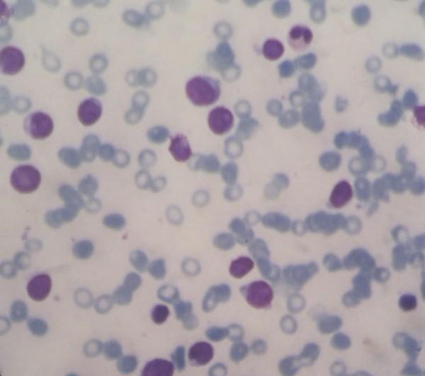 https://cdn.ncbi.nlm.nih.gov/pmc/blobs/c2e3/4077677/d16d5c114438/1752-1947-8-168-2.jpg