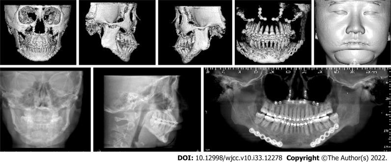 https://cdn.ncbi.nlm.nih.gov/pmc/blobs/c2ef/9724535/26a6da32a90d/WJCC-10-12278-g007.jpg