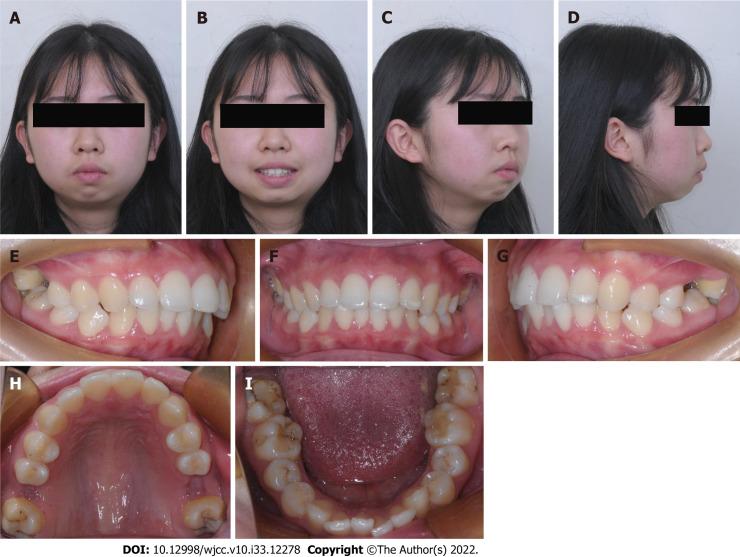 https://cdn.ncbi.nlm.nih.gov/pmc/blobs/c2ef/9724535/c8cf3f635775/WJCC-10-12278-g001.jpg