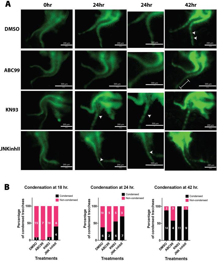 https://cdn.ncbi.nlm.nih.gov/pmc/blobs/c2f2/12015613/de4e7153523c/fcell-13-1523833-g003.jpg