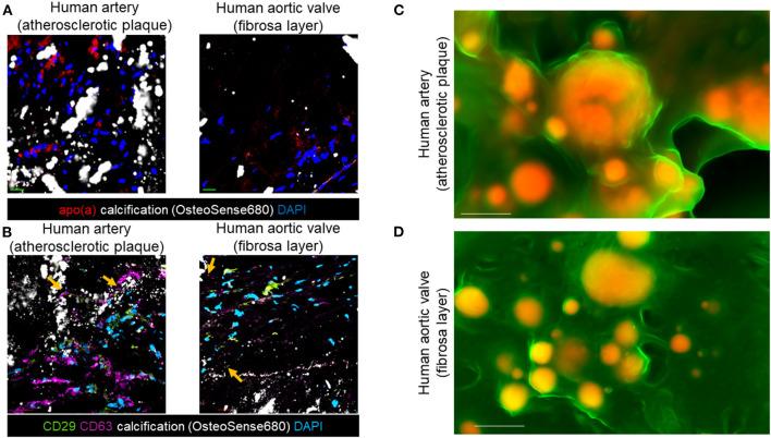 https://cdn.ncbi.nlm.nih.gov/pmc/blobs/c2f2/8831739/132787e7e5fb/fcvm-09-778919-g0002.jpg