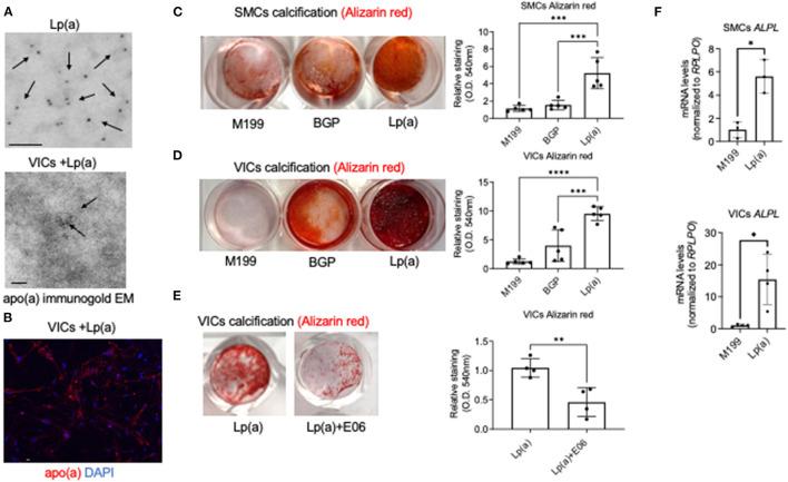 https://cdn.ncbi.nlm.nih.gov/pmc/blobs/c2f2/8831739/558a5855c2f7/fcvm-09-778919-g0001.jpg