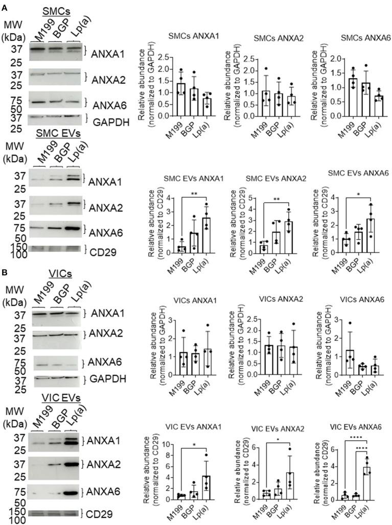 https://cdn.ncbi.nlm.nih.gov/pmc/blobs/c2f2/8831739/c2271158ea59/fcvm-09-778919-g0004.jpg