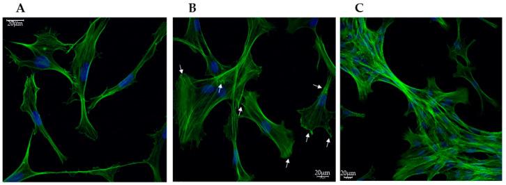 https://cdn.ncbi.nlm.nih.gov/pmc/blobs/c2fa/12108999/4246d601b0ba/biomedicines-13-01127-g001.jpg