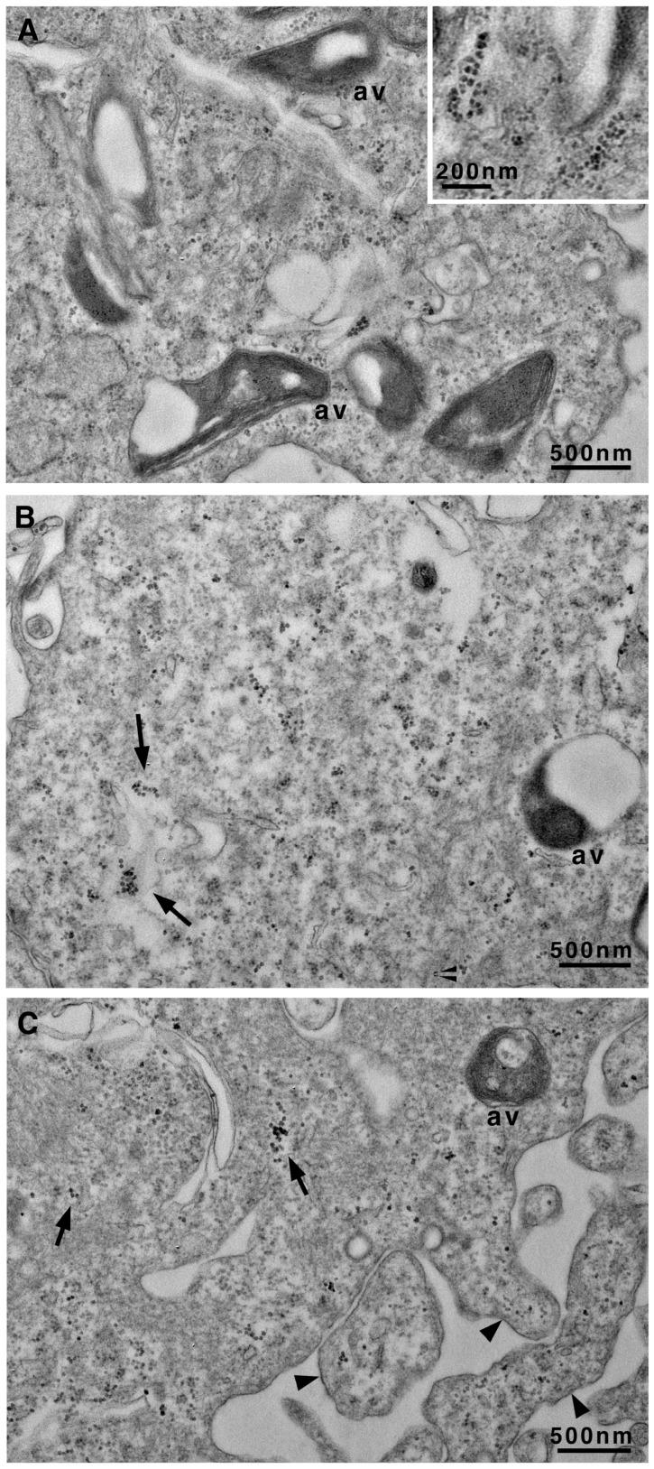https://cdn.ncbi.nlm.nih.gov/pmc/blobs/c2fa/12108999/fcddd235afe1/biomedicines-13-01127-g004.jpg