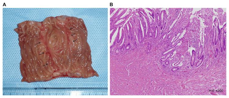 https://cdn.ncbi.nlm.nih.gov/pmc/blobs/c2fd/12343158/dab8a1e319c0/cureus-0017-00000087856-i03.jpg