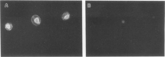 https://cdn.ncbi.nlm.nih.gov/pmc/blobs/c2fe/364542/5ba237dc9c32/molcellb00029-0395-b.jpg