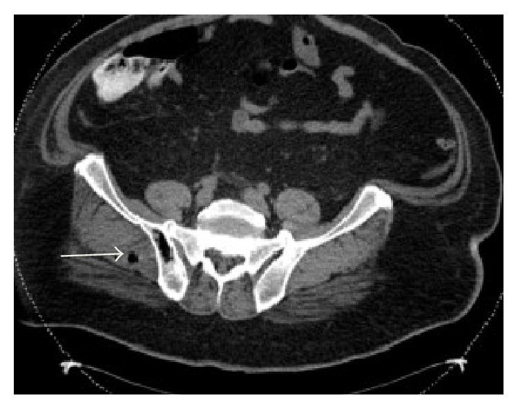 https://cdn.ncbi.nlm.nih.gov/pmc/blobs/c2ff/4697071/18d351f5bb84/CRIID2015-694247.003.jpg