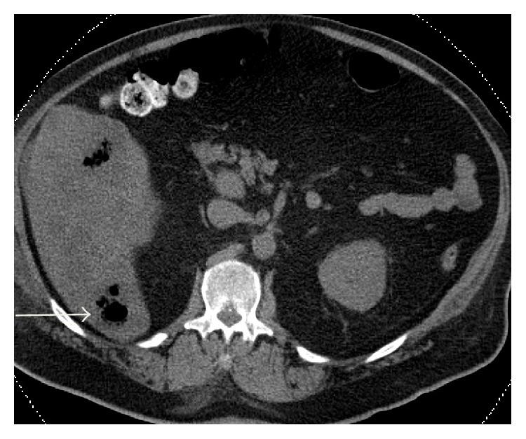 https://cdn.ncbi.nlm.nih.gov/pmc/blobs/c2ff/4697071/9a109bf657da/CRIID2015-694247.001.jpg