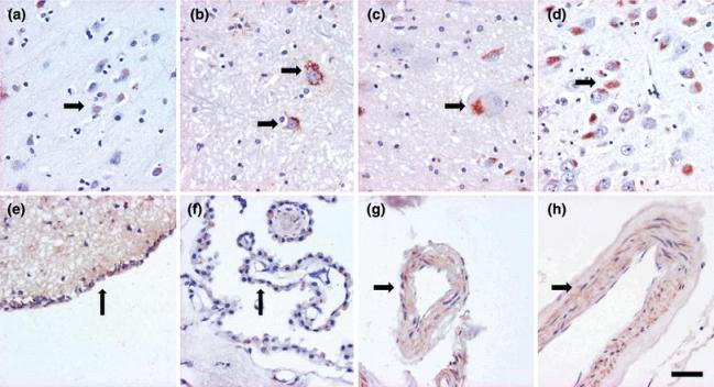 https://cdn.ncbi.nlm.nih.gov/pmc/blobs/c302/2910889/343dbc07d62e/401_2009_485_Fig2_HTML.jpg