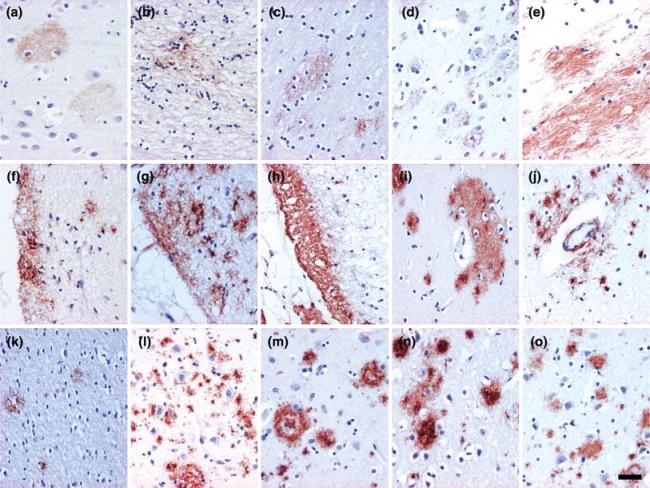 https://cdn.ncbi.nlm.nih.gov/pmc/blobs/c302/2910889/dac1555abf8d/401_2009_485_Fig3_HTML.jpg