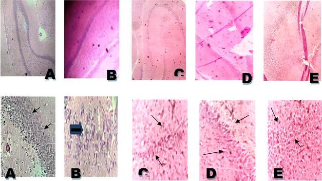 https://cdn.ncbi.nlm.nih.gov/pmc/blobs/c308/8381014/14f821585c77/gr11.jpg