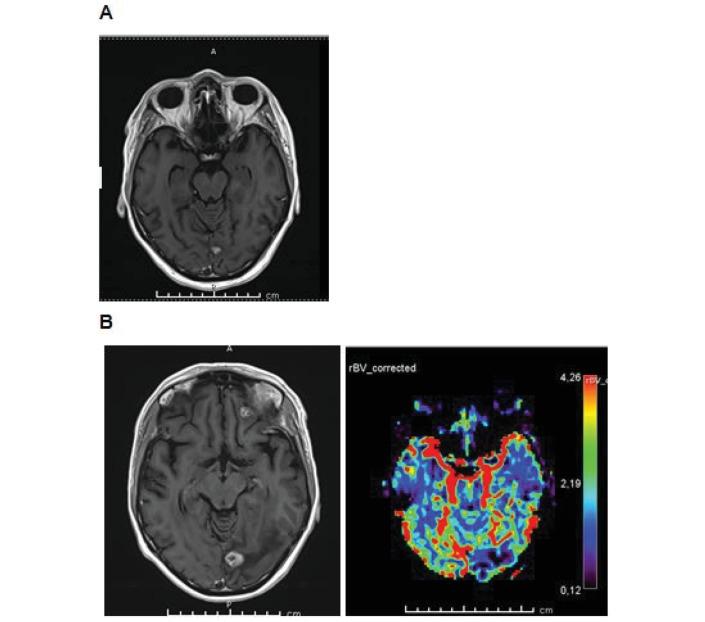 https://cdn.ncbi.nlm.nih.gov/pmc/blobs/c30a/5786916/284a7e7a3db4/esmoopen-2017-000262f02.jpg