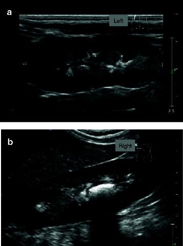 https://cdn.ncbi.nlm.nih.gov/pmc/blobs/c311/4515929/381a4a04a763/12876_2015_316_Fig1_HTML.jpg
