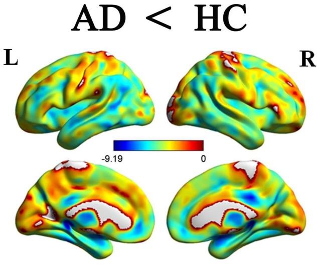 https://cdn.ncbi.nlm.nih.gov/pmc/blobs/c314/5432635/3f70879f1a0e/fnagi-09-00143-g0002.jpg
