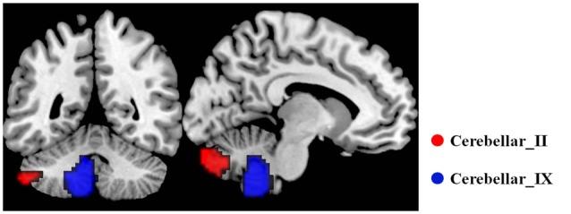https://cdn.ncbi.nlm.nih.gov/pmc/blobs/c314/5432635/40ccf087f71c/fnagi-09-00143-g0001.jpg