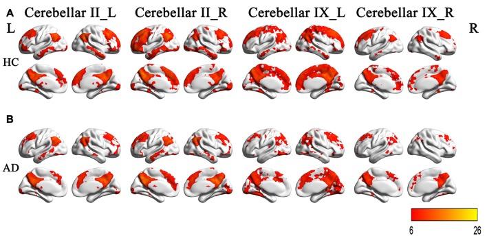 https://cdn.ncbi.nlm.nih.gov/pmc/blobs/c314/5432635/49f7b5ccf79b/fnagi-09-00143-g0003.jpg