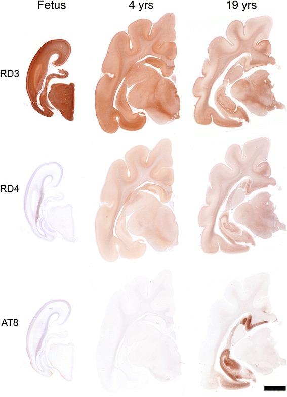 https://cdn.ncbi.nlm.nih.gov/pmc/blobs/c316/4674944/93f4b4a7c165/40478_2015_258_Fig2_HTML.jpg