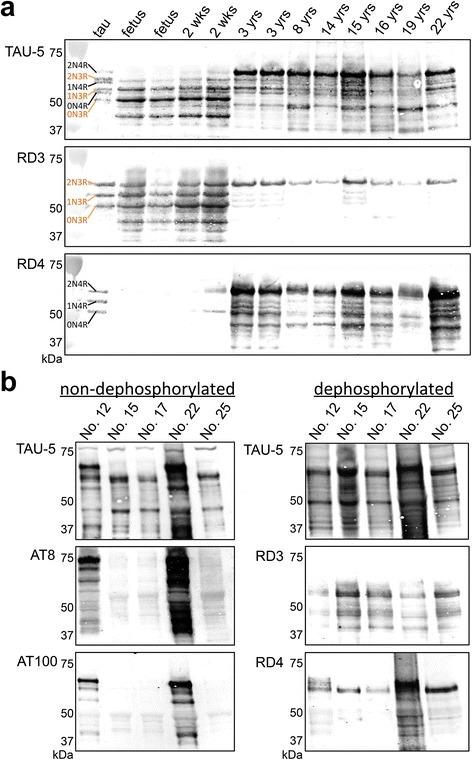 https://cdn.ncbi.nlm.nih.gov/pmc/blobs/c316/4674944/d108ec950c25/40478_2015_258_Fig4_HTML.jpg