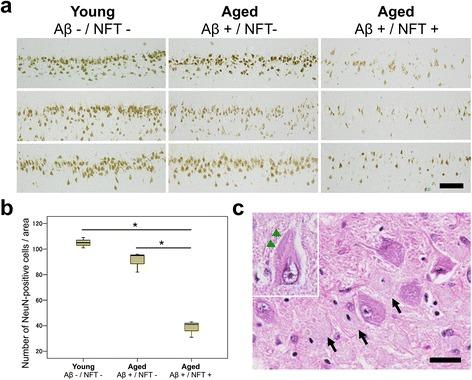 https://cdn.ncbi.nlm.nih.gov/pmc/blobs/c316/4674944/da84e6fc2e1d/40478_2015_258_Fig6_HTML.jpg